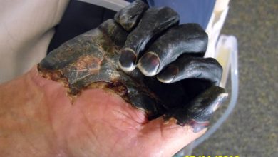 Photo of AJ Rice: Is the Bubonic Plague Coming to Filthy Los Angeles?