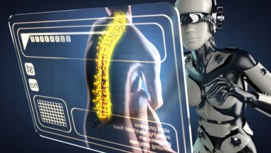 Photo of Cyborg Spine Implants Grant Women Relief After Years of Pain
