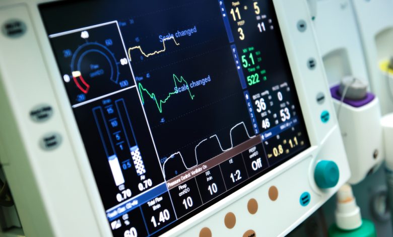 Image of a ventilator screen.