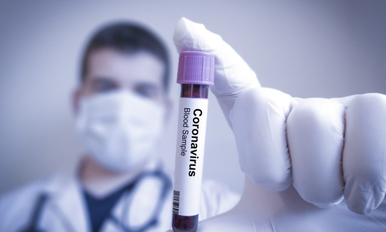 Doctor Holding Vial Marked "Coronavirus"
