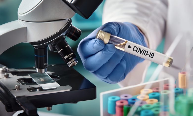 Doctor in a laboratory with a biological tube for analysis and sampling of Covid-19.